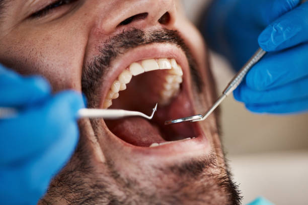 Best Emergency Tooth Extraction in St Martins, MO