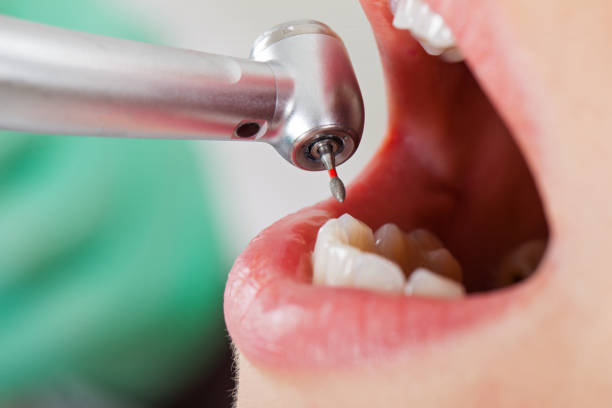 Best Emergency Broken Tooth Repair in St Martins, MO